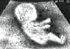 Ultrasound Sonogram baby